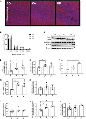 Differential Response of Hippocampal and Cerebrocortical Autophagy and Ketone Body Metabolism to the Ketogenic Diet